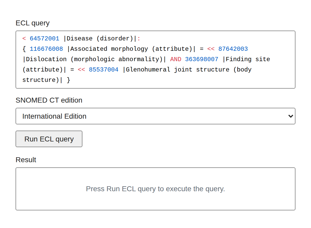 ECL Editor